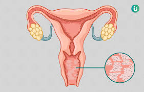 images 1 - سوزش واژن ؛ داروی سوزش واژن ؛ علت سوزش واژن ؛ درمان سوزش واژن